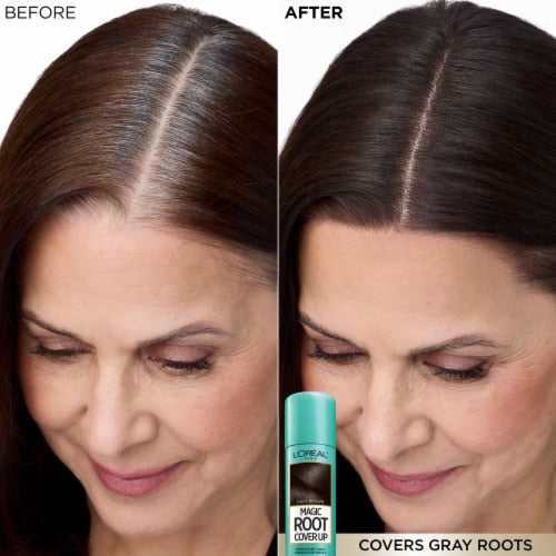 L'Oreal Root Cvrup Med Blndw 2 oz product image 1
